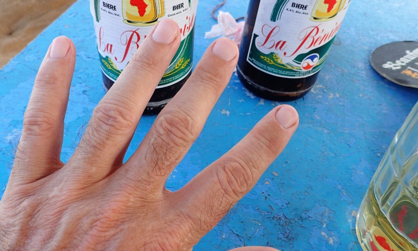 The world's best mani-pedi service in Cotonou, Benin